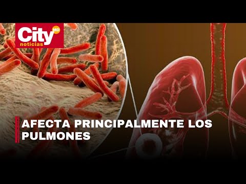 Alertan por aumento de tuberculosis en Colombia | CityTv