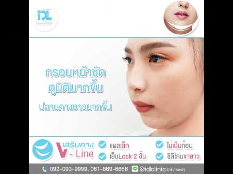 IDLReview:เสริมคาง𝑽-𝑳𝒊𝒏𝒆เพ