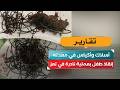 أسلاك وأكياس في معدته.. إنقاذ طفل بعملية نادرة في تعز