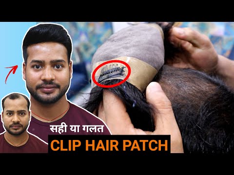 Clip On Hair Patch Kit at Best Price in New Delhi | Looks Forever