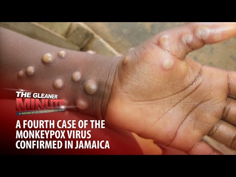 THE GLEANER MINUTE: Fourth monkeypox case in Ja | Soldier dies in crash | New WL time for Shelly