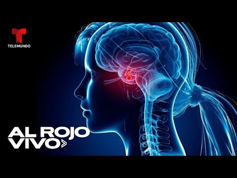 El cerebro de la mujer reduce su tamaño durante el embarazo, según estudio