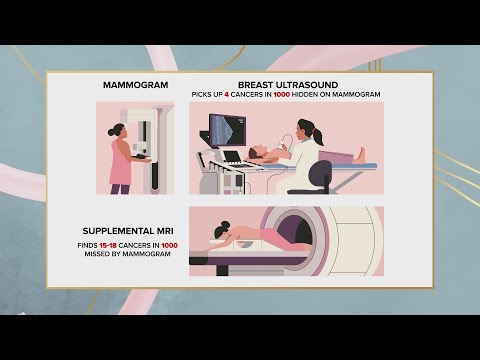 New guidelines for mammograms