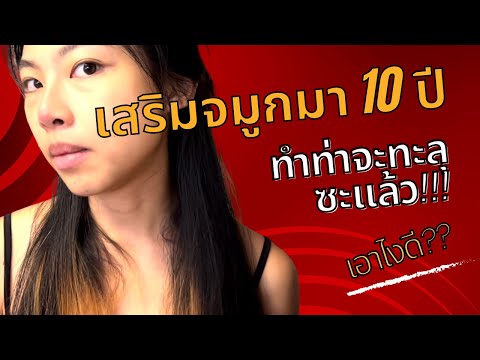 เสริมจมูกมา10ปีพึ่งมีเรื่อง