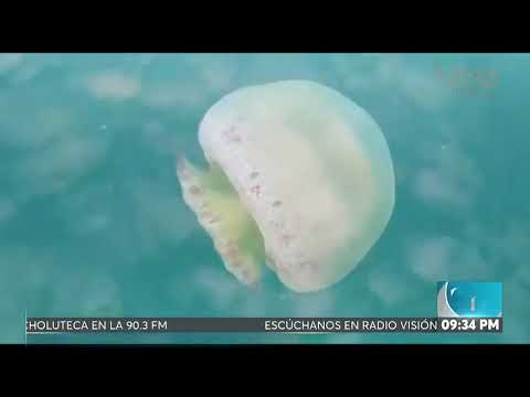 ON ESTELAR l Ola de medusas en Omoa, Cortés deja a 4 niños en estado crítico
