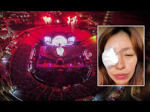 Fanática de Karol G casi pierde el ojo por culpa de fuegos artificiales durante concierto en Lima