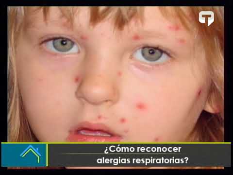 ¿Cómo reconocer alergias respiratorias?