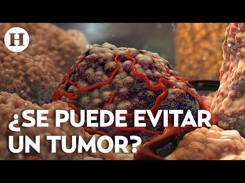 ¡No fumar y no tomar! Hábitos relacionados con la aparición de tumores malignos; alerta doctor