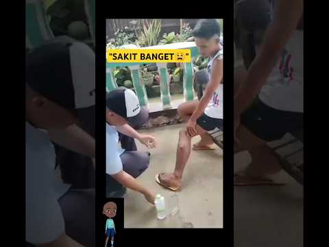 "Pria Ini Bantu Keponakannya Keluarkan Mata Bisul dari Tubuhnya! 😱" #viralshorts  #shorts