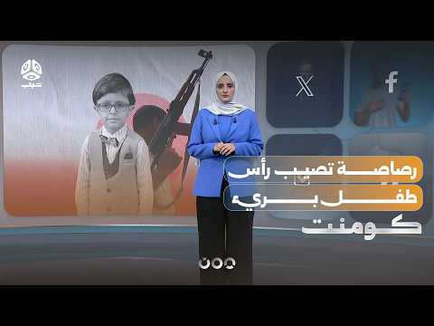رصاصة طائشة تصيب رأس طفل في إب | كومنت