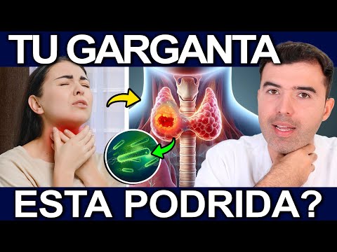 CURA TU DOLOR DE GARGANTA EN 1 DIA - Causas Y Soluciones Para  La Amigdalitis O Amigdalas Inflamadas