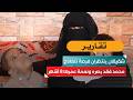 محمد فقد بصره ونعمة عمرها 8 أشهر.. شقيقان ينتظران فرصة للعلاج