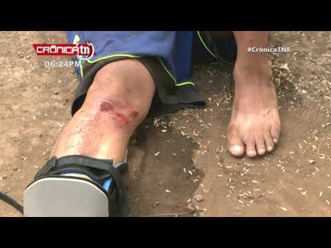 Ciudadano sufrió una repentina caída en su bicicleta en las calles de Managua - Nicaragua