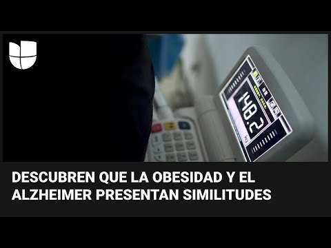 La obesidad puede causar cambios en el cerebro similares al Alzheimer, según estudio