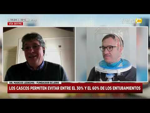 Coronavirus en Argentina: Un casco que podría reemplazar a los respiradores en Hoy Nos Toca
