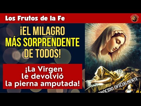 ¡El Milagro más Sorprendente de la Historia! Pidió a la Virgen y le Devolvió la Pierna Amputada