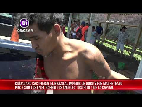 Managua: Machetean al Chelito después de defender a una joven cuando le querían robar