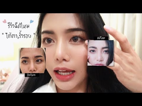 ปังมาก!!-แก้ใต้ตาคล้ำ-รีวิวฉีด ปังมาก!!-แก้ใต้ตาคล้ำ-รีวิวฉีด