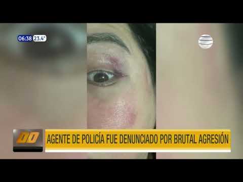 Luque: Agente de la Policía fue denunciado por brutal agresión