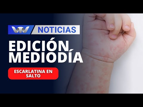 Edición Mediodía 21/11 | Niña de cinco años falleció  por escarlatina en Salto