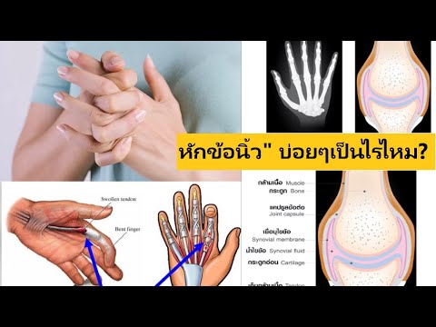 ผลเสียของการหักข้อนิ้วมือบ่อย