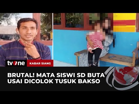 Kronologi Mata Siswi SD Di Gresik Buta Setelah Dicolok Dengan Tusukan ...