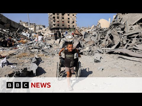 Children in Gaza 'like zombies' because of severe malnutrition, US doctor says | BBC News
