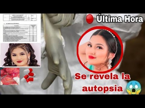 Sale Autopsia de Muñequita Milly