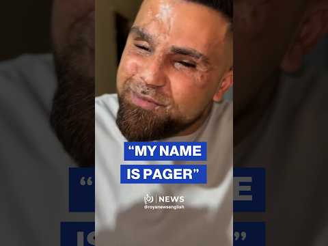 Lebanese Pager Explosion Survivor Shares His Story with Humor and Resilience