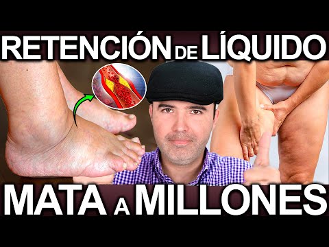 ELIMINA LA RETENCION DE LIQUIDO Y LA HINCHAZON PARA SIEMPRE