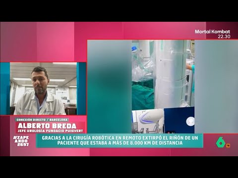 Un médico opera en remoto a un paciente que estaba a 8.000 kilómetros de distancia - Zapeando