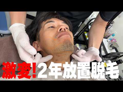 【激痛?】脱毛2年放置→再開したら激変した件