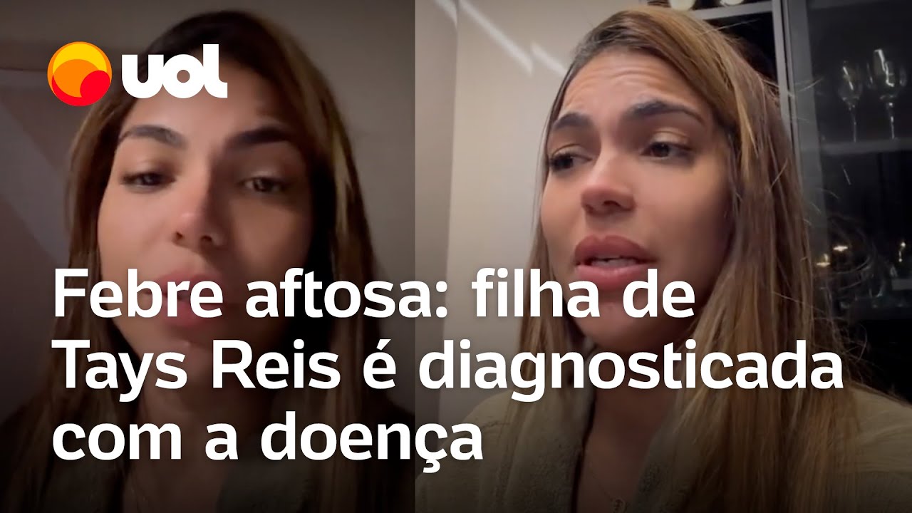 Febre aftosa: Tays Reis faz alerta após filha ser diagnosticada com a doença