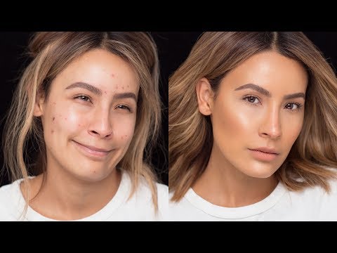 FLAWLESS SKIN WITH ACNE BREAKOUTS | DESI PERKINS