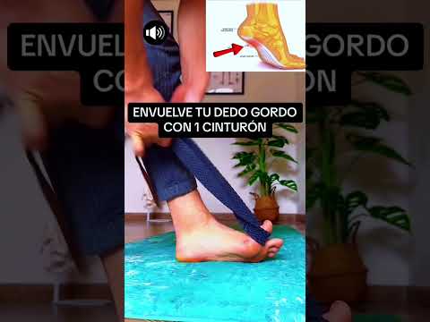 Fascitis Plantar: Menos dolor en el pie haciendo esto