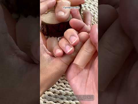 믿기 힘든 현실감: 초현실적인 <strong>실리콘</strong> 의수 착용 후기 — 실물과 같은 <strong>실리콘</strong> 의수의 놀라운 과학과 맞춤형 의료용 의수의 제작 및 장착 과정!