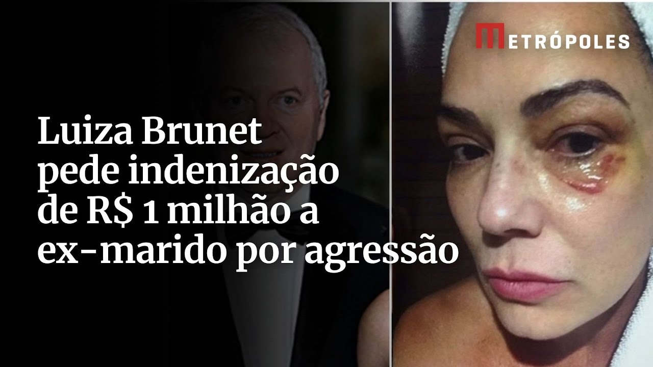 Luiza Brunet pede indenização de R$ 1 milhão a ex marido por agressão