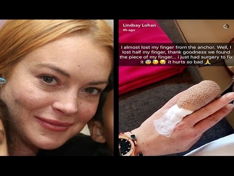Lindsay Lohan Loses Part of Finger in Boating Accident