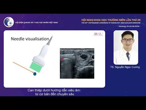 2. Can thiệp dưới hướng dẫn siêu âm: từ cơ bản đến chuyên sâu (TS. Nguyễn Ngọc Cương)