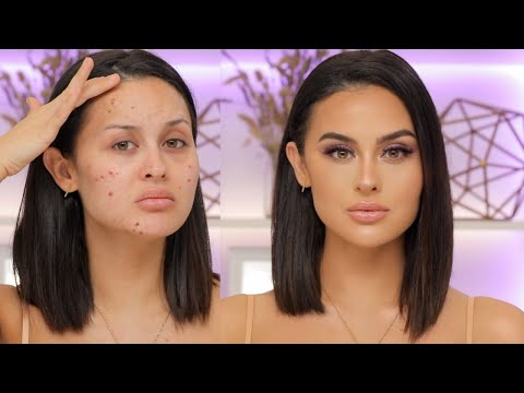 Flawless Skin Transformation With Makeup For Acne Breakouts