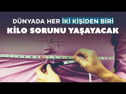 2030 yılında dünya nüfusunun yarısının fazla kilolu veya obez olacağı öngörülüyor