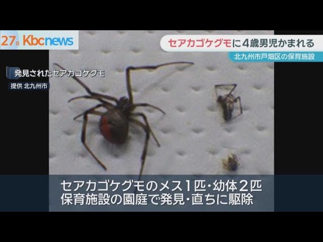 Image of Anak Berusia Empat Tahun Digigit Laba-Laba Redback