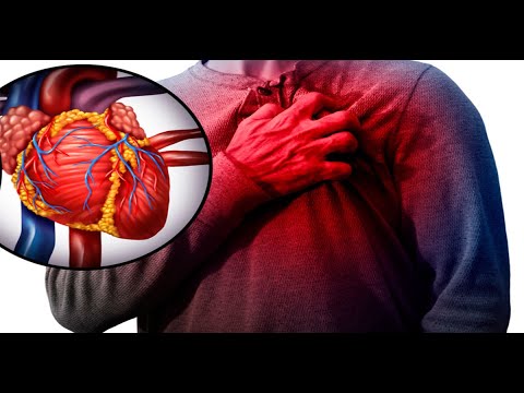 Infartos al miocardio siguen siendo la principal causa de muerte en el país