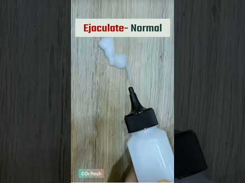 MALE DISCHARGE. #Male discharge #Ejaculation #Semen #shorts