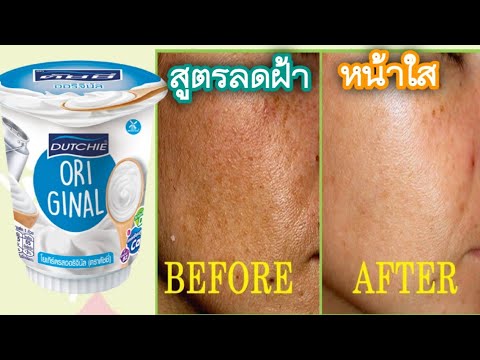 สูตร-ลดฝ้า-กระ-จุดด่างดำ-ด้วย- สูตร-ลดฝ้า-กระ-จุดด่างดำ-ด้วย-