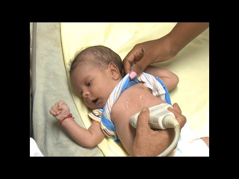 Presenta Cienfuegos elevado indicador de mortalidad infantil en primer semestre del año