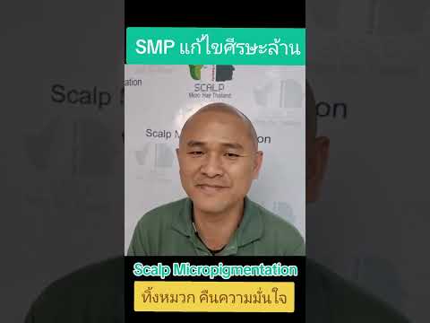 SMPแก้ไขศีรษะล้านทิ้งหมวกคื