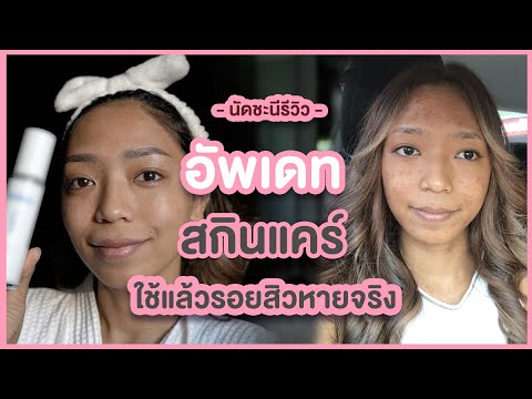 อัพเดทสกินแคร์-:-itemเด็ด-สำหร อัพเดทสกินแคร์-:-itemเด็ด-สำหร