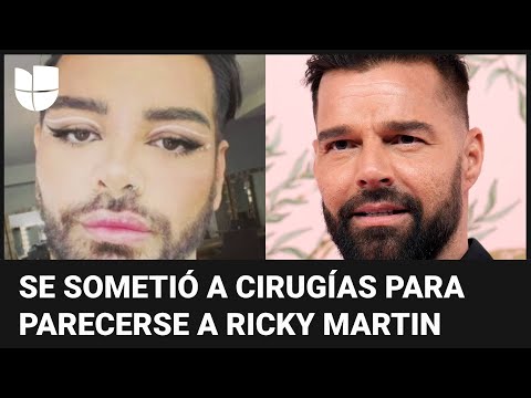 Hombre que se sometió a más de 30 cirugías para parecerse a Ricky Martin casi muere