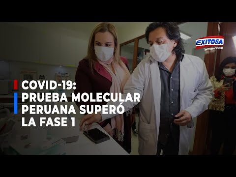 Covid-19 I Prueba molecular peruana ya superó la fase 1 y está cerca de hacerse realidad